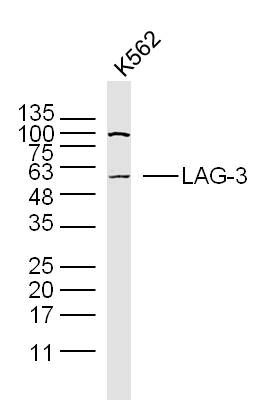 Fig2: Sample: K562 Cell (Human) Lysate at 40 ug; Primary: Anti-LAG-3 at 1/300 dilution; Secondary: IRDye800CW Goat Anti-Rabbit IgG at 1/20000 dilution; Predicted band size: 58 kD; Observed band size: 58 kD