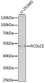 Western blot - PCOLCE Polyclonal Antibody 