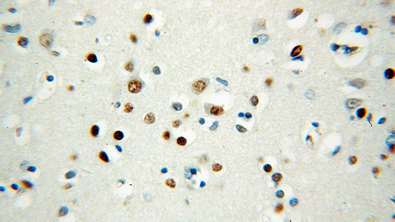Immunohistochemical of paraffin-embedded human brain using Catalog No:107594(SMN2 antibody) at dilution of 1:50 (under 40x lens)