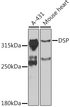 Western blot - DSP Polyclonal Antibody 