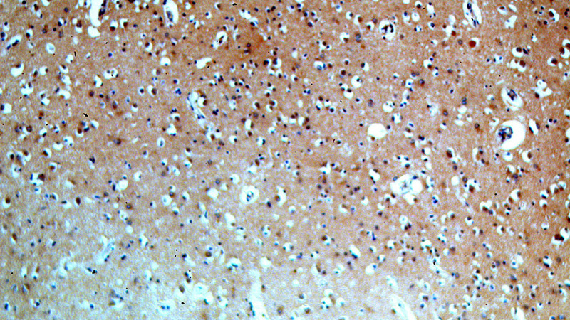 Immunohistochemical of paraffin-embedded human brain using Catalog No:115247(SIRT6 antibody) at dilution of 1:50 (under 10x lens)