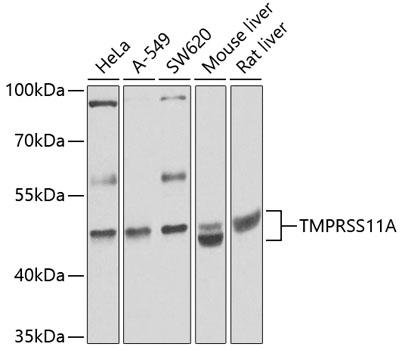 Western blot - TMPRSS11A Polyclonal Antibody 