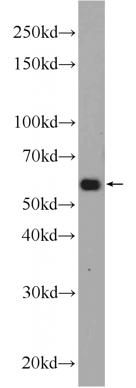 HEK-293 cells were subjected to SDS PAGE followed by western blot with Catalog No:116101(TMEM161A Antibody) at dilution of 1:1000