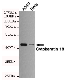 Western blot detection of Cytokeratin 18 in A549 and Hela cell lysates using Cytokeratin 18 mouse mAb (1:1000 diluted).Predicted band size:48KDa.Observed band size:48KDa.