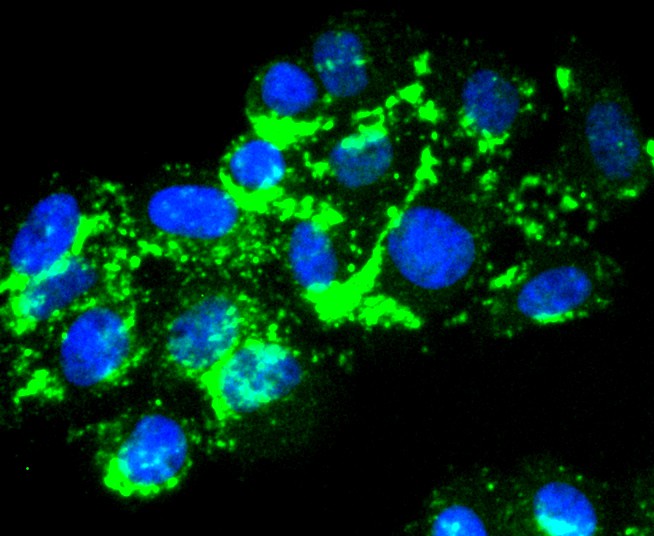 Fig3:; ICC staining of Laminnin 5 alpha 3 in HepG2 cells (green). Formalin fixed cells were permeabilized with 0.1% Triton X-100 in TBS for 10 minutes at room temperature and blocked with 1% Blocker BSA for 15 minutes at room temperature. Cells were probed with the primary antibody ( 1/50) for 1 hour at room temperature, washed with PBS. Alexa Fluor®488 Goat anti-Rabbit IgG was used as the secondary antibody at 1/1,000 dilution. The nuclear counter stain is DAPI (blue).