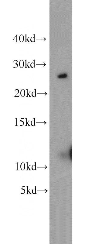 mouse liver tissue were subjected to SDS PAGE followed by western blot with Catalog No:109416(CMTM8 antibody) at dilution of 1:1000