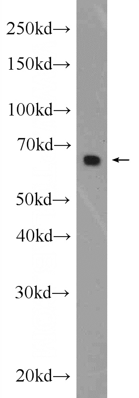 HEK-293 cells were subjected to SDS PAGE followed by western blot with Catalog No:112957(SLC13A1 Antibody) at dilution of 1:1000