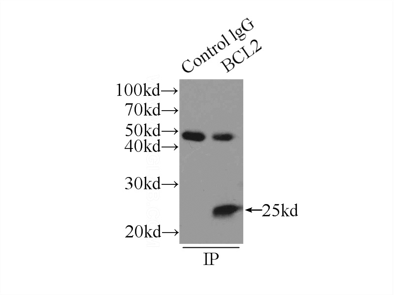 IP Result of anti-BCL2 (IP:Catalog No:108391, 3ug; Detection:Catalog No:108391 1:1000) with MCF-7 cells lysate 2500ug.