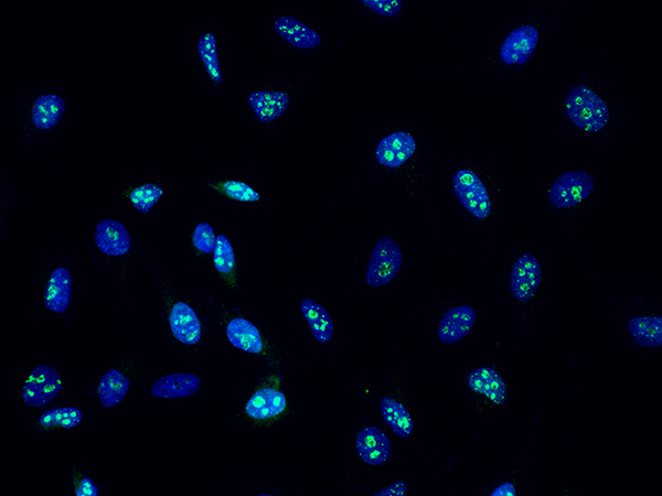 MKI67 Antibody, Mouse MAb, Immunofluorescence