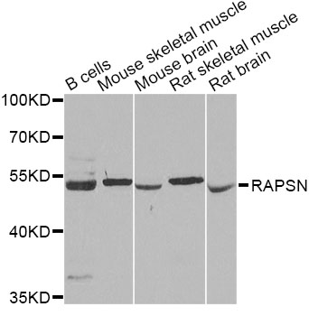 Western blot - RAPSN Polyclonal Antibody 