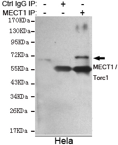 Immunoprecipitation analysis of Hela cell lysate using MECT1 / Torc1 mouse mAb.