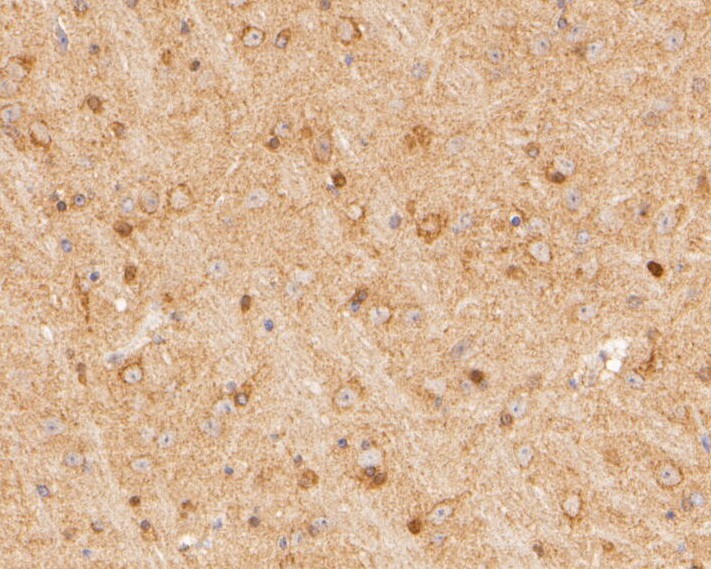 Fig2:; Immunohistochemical analysis of paraffin-embedded mouse brian tissue using anti-SYNDIG1 antibody. The section was pre-treated using heat mediated antigen retrieval with Tris-EDTA buffer (pH 8.0-8.4) for 20 minutes.The tissues were blocked in 5% BSA for 30 minutes at room temperature, washed with ddH; 2; O and PBS, and then probed with the primary antibody ( 1/200) for 30 minutes at room temperature. The detection was performed using an HRP conjugated compact polymer system. DAB was used as the chromogen. Tissues were counterstained with hematoxylin and mounted with DPX.