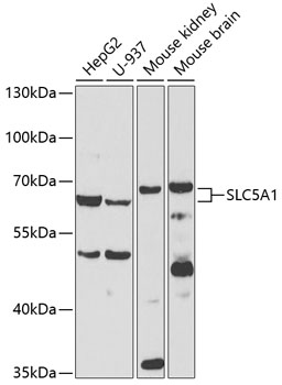 Western blot - SLC5A1 Polyclonal Antibody 