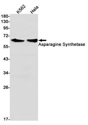 Western blot detection of Asparagine Synthetase in K562,Hela cell lysates using Asparagine Synthetase Rabbit mAb(1:1000 diluted).Predicted band size:64kDa.Observed band size:64kDa.