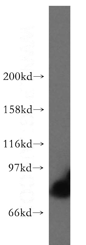 HeLa cells were subjected to SDS PAGE followed by western blot with Catalog No:115690(STAT4 antibody) at dilution of 1:1000