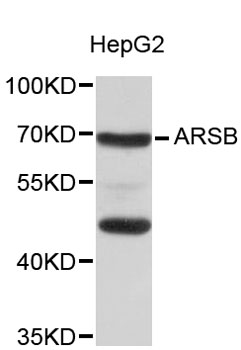 Western blot - ARSB Polyclonal Antibody 