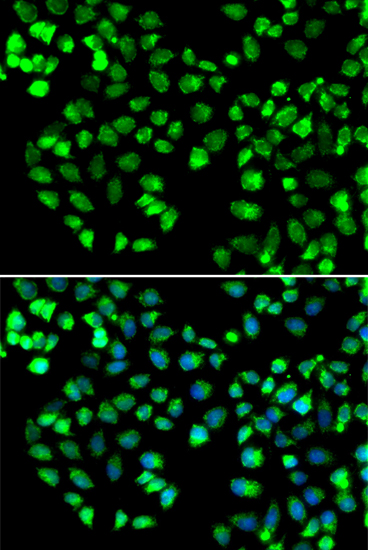 Immunofluorescence - GRM4 Polyclonal Antibody 