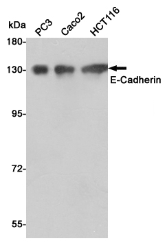 Western blot detection of E-Cadherin in PC3,Caco2 and HCT116 cell lysates using E-Cadherin mouse mAb(dilution 1:500).Predicted band size:135kDa.Observed band size:135kDa.