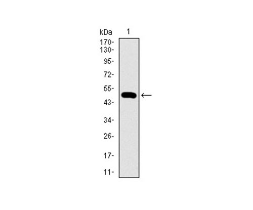 Fig1: Western blot analysis of WHSC2 on human WHSC2 recombinant protein using anti-WHSC2 antibody at 1/1,000 dilution.