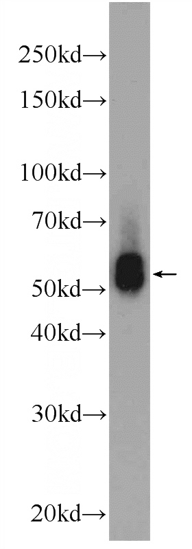 HeLa cells were subjected to SDS PAGE followed by western blot with Catalog No:112087(KLHDC5 Antibody) at dilution of 1:1000