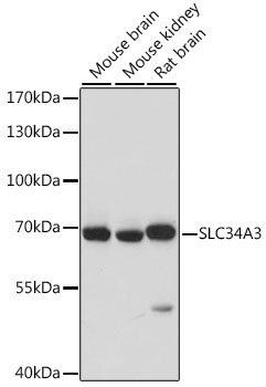Western blot - SLC34A3 Polyclonal Antibody 