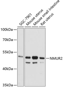 Western blot - NMUR2 Polyclonal Antibody 