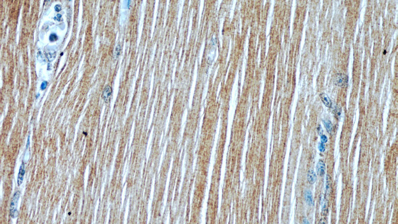 Immunohistochemical of paraffin-embedded human skeletal muscle using Catalog No:108343(ATP1A2 antibody) at dilution of 1:50 (under 40x lens)