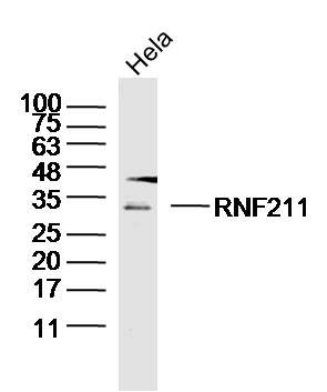 Fig1: Sample: Hela Cell (Human)Lysate at 30 ug; Primary: Anti-RNF211 at 1/300 dilution; Secondary: IRDye800CW Goat Anti-Rabbit IgG at 1/20000 dilution; Predicted band size: 30kD; Observed band size: 30kD