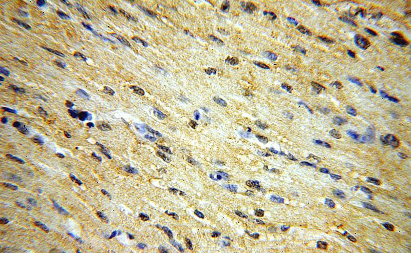 Immunohistochemical of paraffin-embedded human heart using Catalog No:115704(STEAP2-Specific antibody) at dilution of 1:100 (under 40x lens)