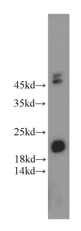 mouse thymus tissue were subjected to SDS PAGE followed by western blot with Catalog No:109021(CD3G antibody) at dilution of 1:500