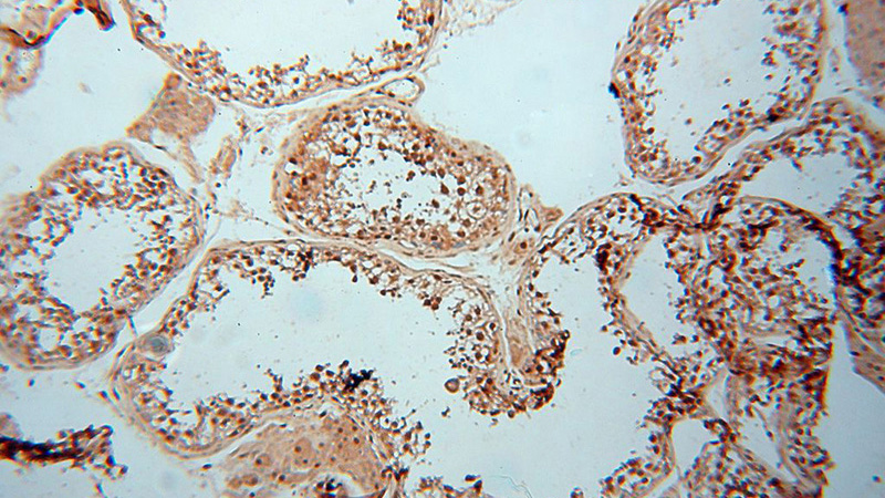 Immunohistochemical of paraffin-embedded human testis using Catalog No:112637(MEF2C-Specific antibody) at dilution of 1:50 (under 10x lens)