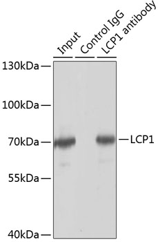 Immunoprecipitation - LCP1 Polyclonal Antibody 