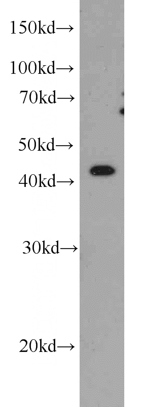 SH-SY5Y cells were subjected to SDS PAGE followed by western blot with Catalog No:107650(TTL antibody) at dilution of 1:500