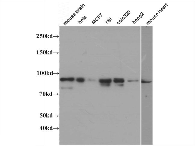 WB result of Catalog No:112662(IMMT antibody) at dliution of 1:1000.