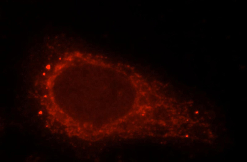 Immunofluorescent analysis of HepG2 cells, using ARRB1 antibody Catalog No:117125 at 1:25 dilution and Rhodamine-labeled goat anti-rabbit IgG (red).