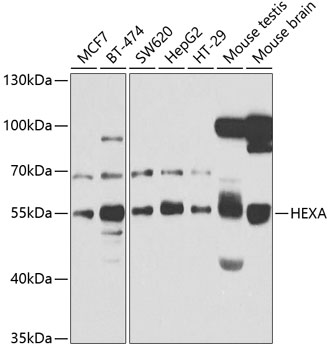 Western blot - HEXA Polyclonal Antibody 
