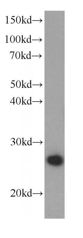 Raji cells were subjected to SDS PAGE followed by western blot with Catalog No:107457(PCMT1 Antibody) at dilution of 1:1000