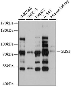 Western blot - GLIS3 Polyclonal Antibody 