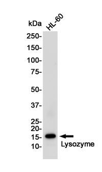 Western blot detection of Lysozyme in HL-60 cell lysates using Lysozyme Rabbit pAb(1:1000 diluted).Predicted band size:17KDa.Observed band size:17KDa.