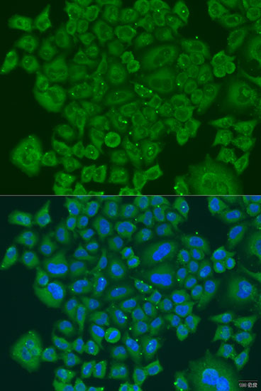 Immunofluorescence - NDUFS7 Polyclonal Antibody 