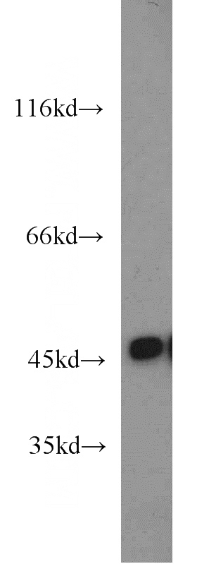 Jurkat cells were subjected to SDS PAGE followed by western blot with Catalog No:110254(ENO3 antibody) at dilution of 1:2000