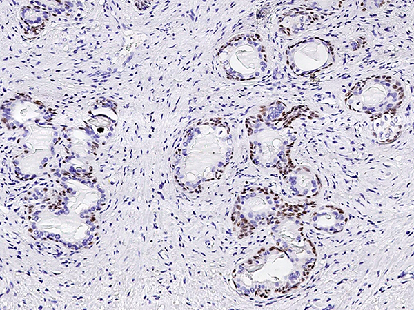 p63 (ΔN) Antibody, Rabbit PAb, Antigen Affinity Purified, Immunohistochemistry