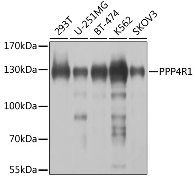 Western blot - PPP4R1 Polyclonal Antibody 