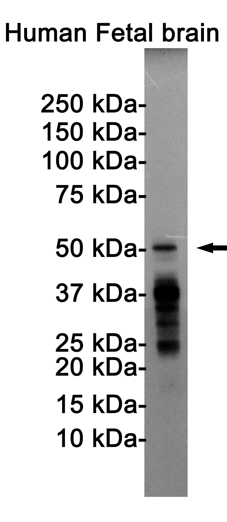 Western blot detection of Tau (Phospho-Thr205) in Human Fetal brain cell lysates using Tau (Phospho-Thr205) Rabbit pAb(1:1000 diluted).Predicted band size:79KDa.Observed band size:50-80KDa.
