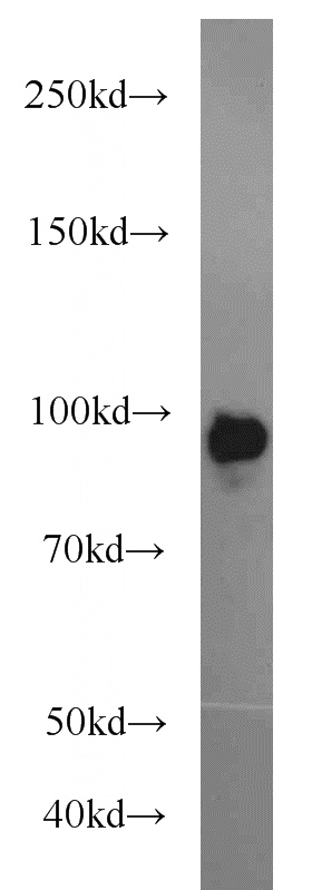 HEK-293 cells were subjected to SDS PAGE followed by western blot with Catalog No:108403(BACH1 antibody) at dilution of 1:1000