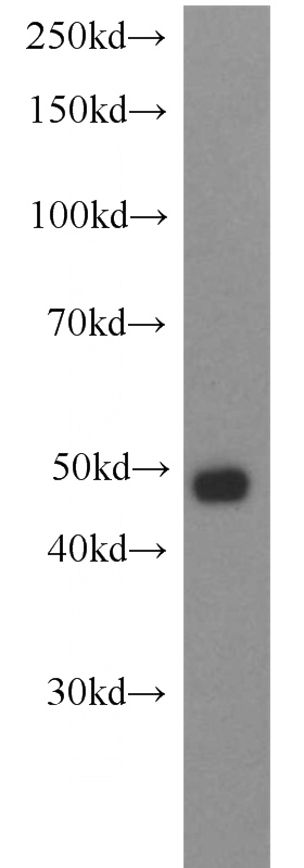 HeLa cells were subjected to SDS PAGE followed by western blot with Catalog No:115453(SNIP1 antibody) at dilution of 1:1500