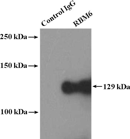 IP Result of anti-RBM6 (IP:Catalog No:114618, 4ug; Detection:Catalog No:114618 1:500) with HeLa cells lysate 2000ug.
