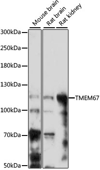 Western blot - TMEM67 Polyclonal Antibody 