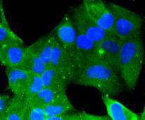 Fig1: Immunocytochemical staining of Hela cells using anti-BMP11 rabbit polyclonal antibody.