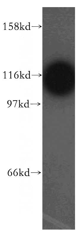 HepG2 cells were subjected to SDS PAGE followed by western blot with Catalog No:110868(GART antibody) at dilution of 1:500